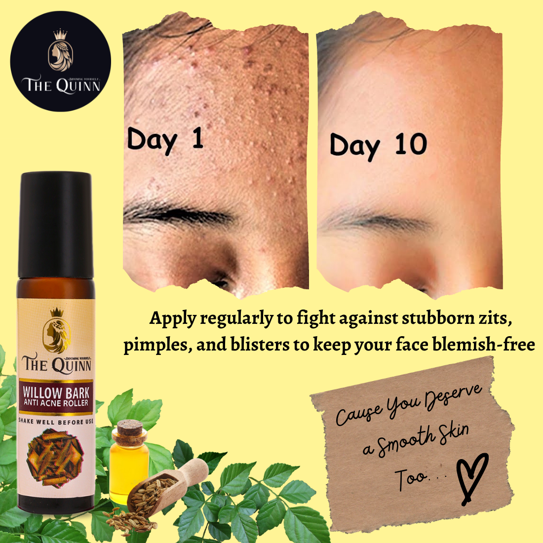 Willow Bark Anti Acne Roller